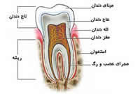 چرا دندان عقل را باید کشید؟