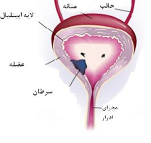 مثانه‌ات را بشناس