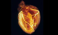 قلبي که بيمار متولد مي شود قلبي که بيمار متولد مي شود