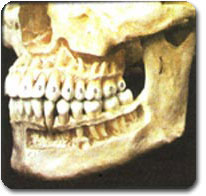 دهان و نحوه نامگذاري دندانها