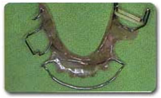 همه چیز در مورد دندانپزشکی