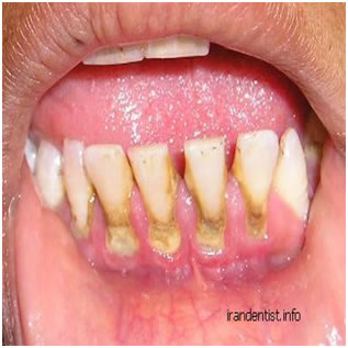 همه چیز در مورد دندانپزشکی