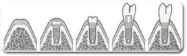 همه چیز در مورد دندانپزشکی