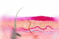 درمان سوختگى هاى ناشى از ليزر