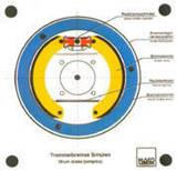 ترمزهای کاسه ای