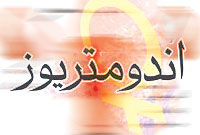آندومتريوز(Endometriosis)