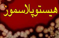 هيستوپلاسموز(Histoplasmosis)