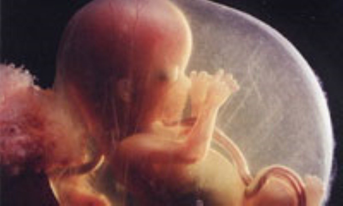 Патология беременности картинки