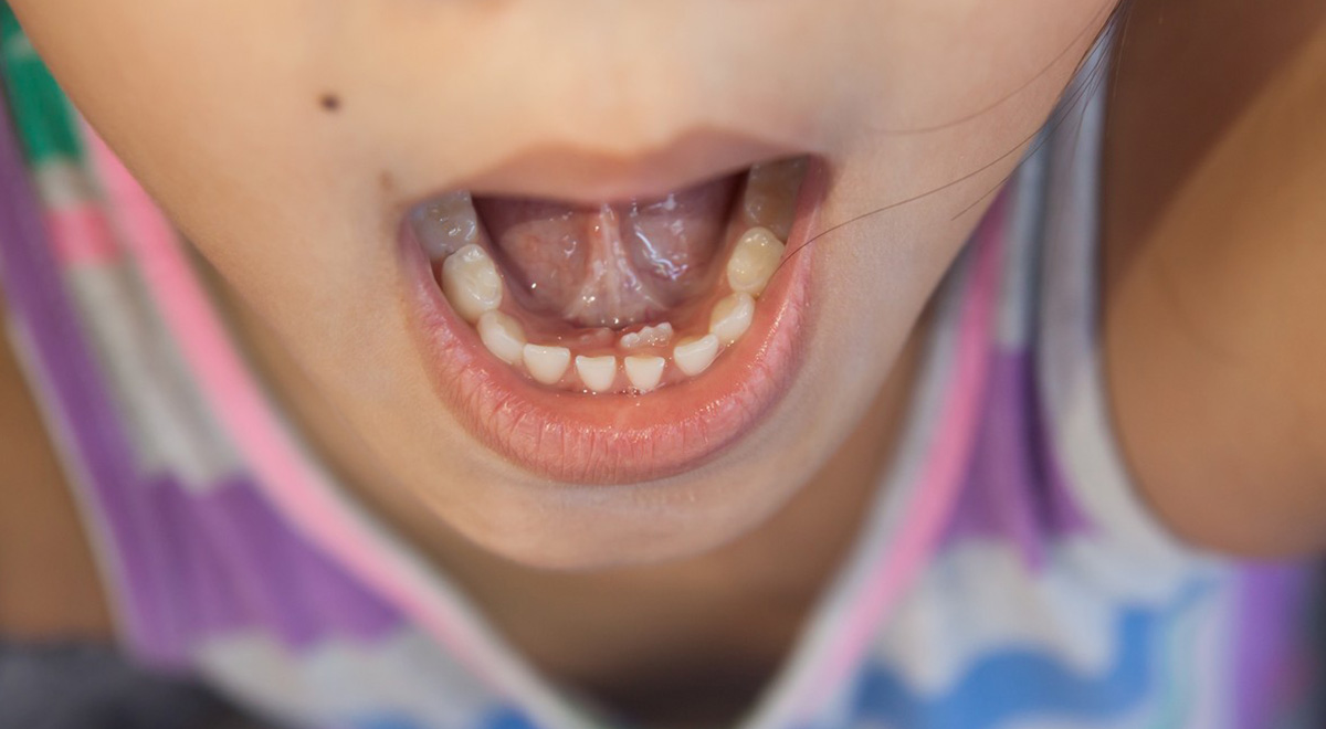 Зубы в младенческом привкусе