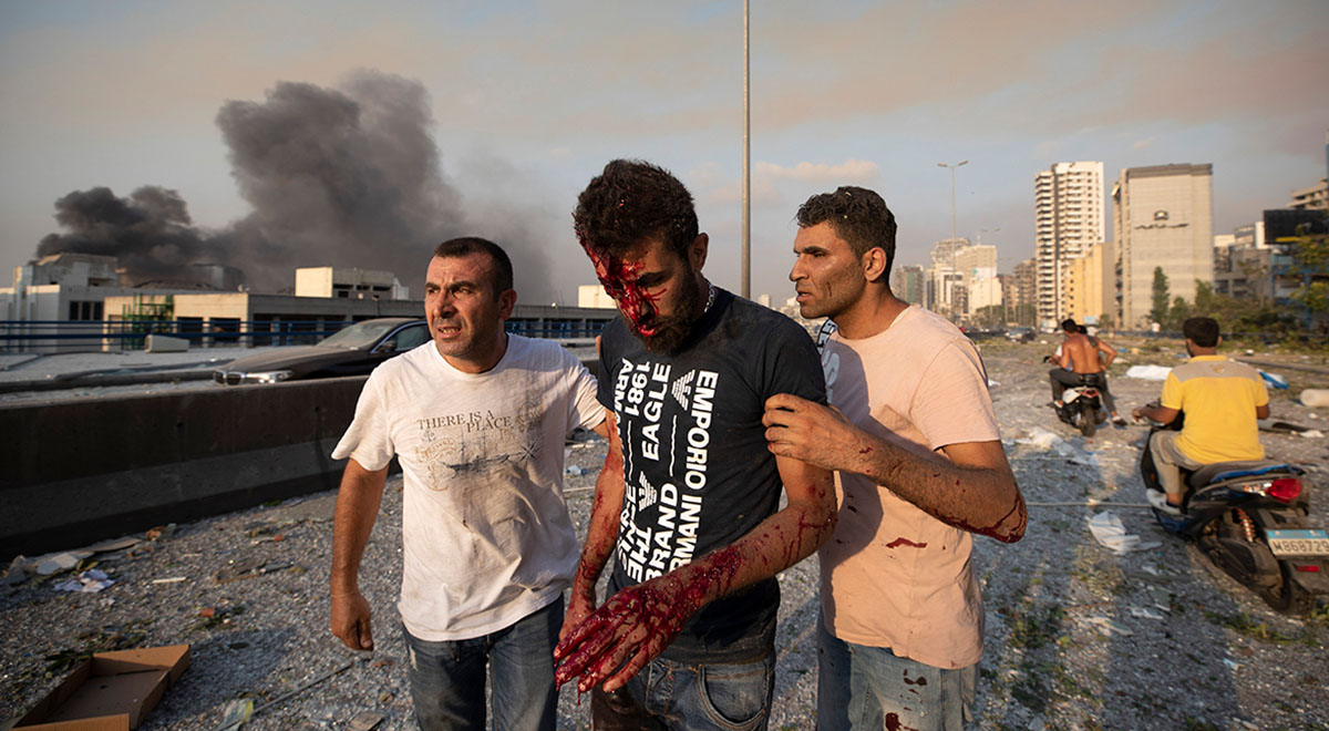 پاسخ دندان شکن جوان لبنانی در منطقه انفجار بیروت به شبکه الحدث سعودی