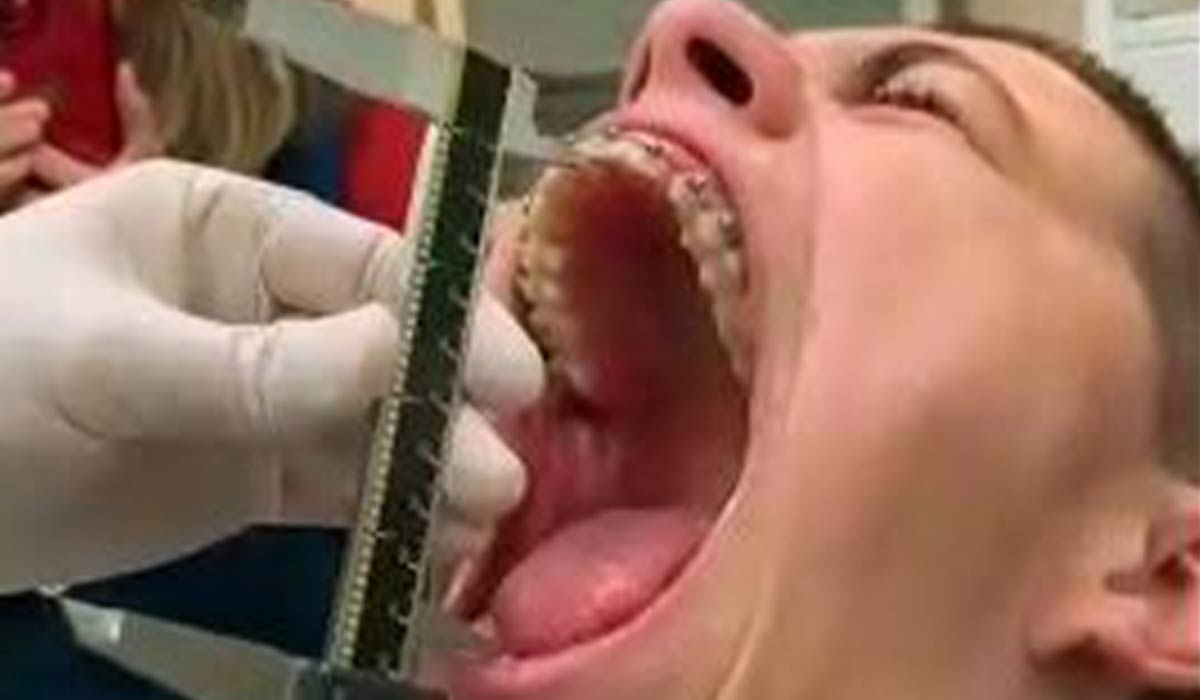 ثبت رکورد دهان گشادترین آدم دنیا