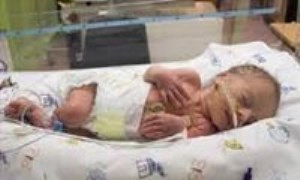 مداخله در هنگام بحران: سندروم مرگ ناگهانی نوزاد
