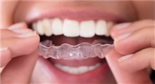 راهکارهایی جهت درمان دندان قروچه در بزرگسالان