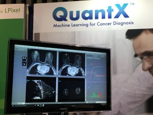 هوش مصنوعی می‌تواند تشخیص دقیق‌تری در مورد سرطان پستان داشته باشد