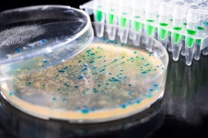 کشف ترکیبی که میکروب‌های مقاوم به آنتی بیوتیک را می‌کشد