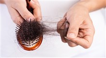 علل و درمان ریزش مو