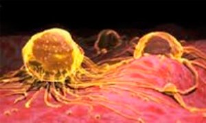 آنکوژن های سلولی و نقش آن ها در سرطان (1)
