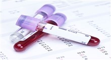 تشخیص سرطان خون از طریق آزمایش خون و تفسیر آن