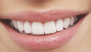 سفید کردن دندان با خوردن ۴ خوراکی طبیعی