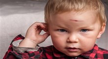 چه زمان به خاطر آسیب دیدگی سر کودک تازه به راه افتاده بایستی به اورژانس مراجعه کنیم؟