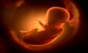 تورم اندام ها در زمان حاملگي