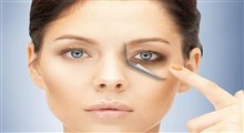 علل اصلی کبودی و سیاهی دور چشم و روش های درمان آن