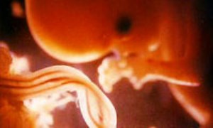 مشكلات شايع، عوارض و بيماريها در بارداري(2)