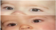 به چه علت چشم نوزادان تغییر رنگ می دهد؟