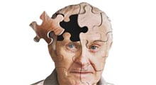 با علائم اولیه آلزایمر آشنا شوید