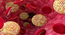راهکارهای طبیعی برای کاهش کلسترول بد خون