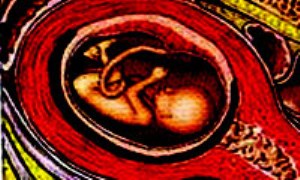 درد شكمي در دوران حاملگي