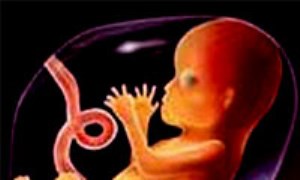 مشكلات شايع، عوارض و بيماريها در بارداري(1)