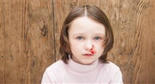خونریزی بینی در کودکان