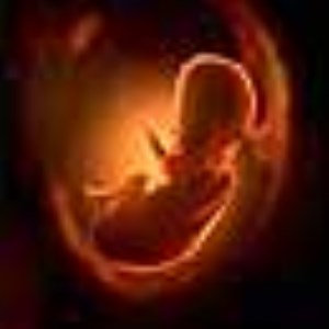 بررسی سقط جنین : انواع سقط جنین ، اهمیت ، خطرات ، نگاه اجتماعی و …