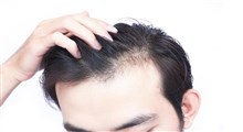 برای درمان ریزش مو چه کنیم؟