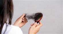 انواع روشهای درمان ریزش مو