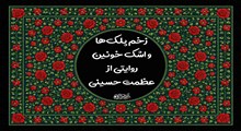 از زخم پلک‌های اهل بیت (ع) تا رسوایی طاغوت‌های تاریخ؛ روایتی از استثنایی‌ترین واقعه عالم