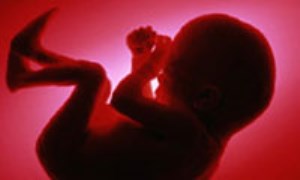 اقدامات و آزمايشات تشخيصي بارداری