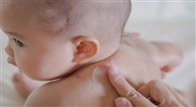 قارچ پوستی در کودکان،علائم و نشانه های آن