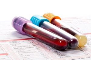 آزمایش خون بارداری و تفسیر نتیجه آن