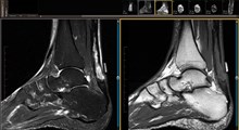 درد پا – علائم، چه چیزی را نشان می‌دهد