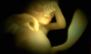 مشكلات شايع، عوارض و بيماريها در بارداري(3)