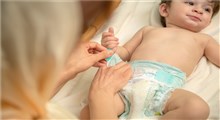 درمان عرق سوز شدن پای نوزادان