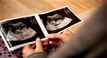 چگونگی تفسیر سونوگرافی هفته 18 بارداری