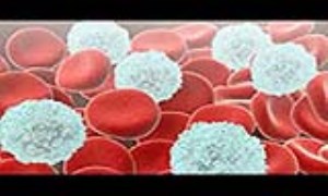 سلولهای سفید خون: بیماریها و اختلالات