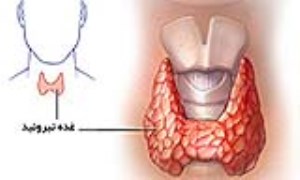 نشانه‌های تیروئید غیر طبیعی