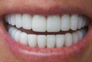 روش های خانگی برای سفید کردن دندان