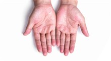 نکاتی برای حفظ سلامت دست ها در روزهای پر شست و شوی کرونایی