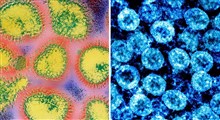 5 تفاوت اساسی کرونا و آنفلوآنزا