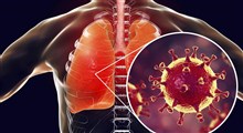 انواع عفونت تنفسی و روش های مقابله با آن (بخش اول)